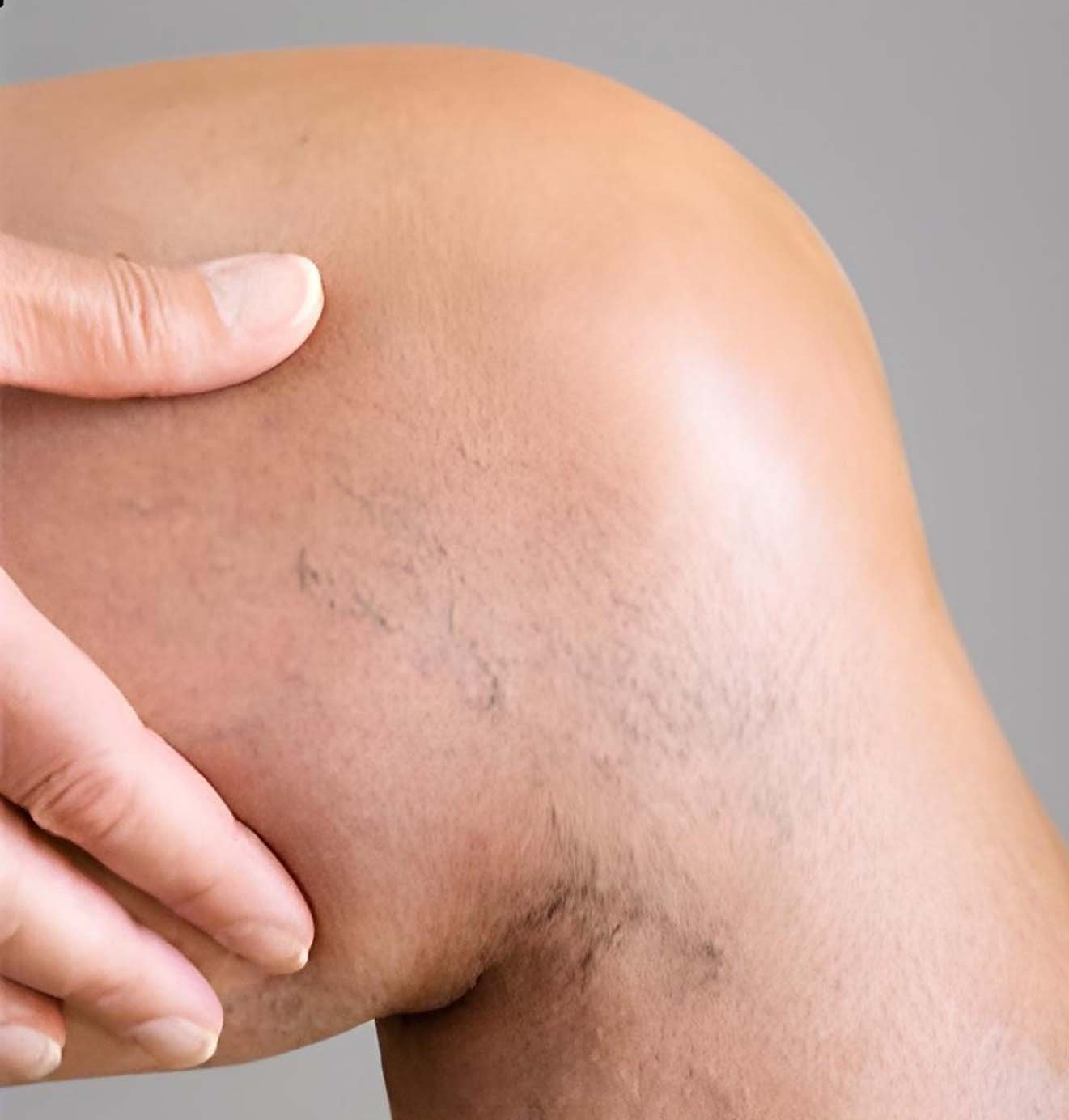 Visible discomfort or stiffness in muscles